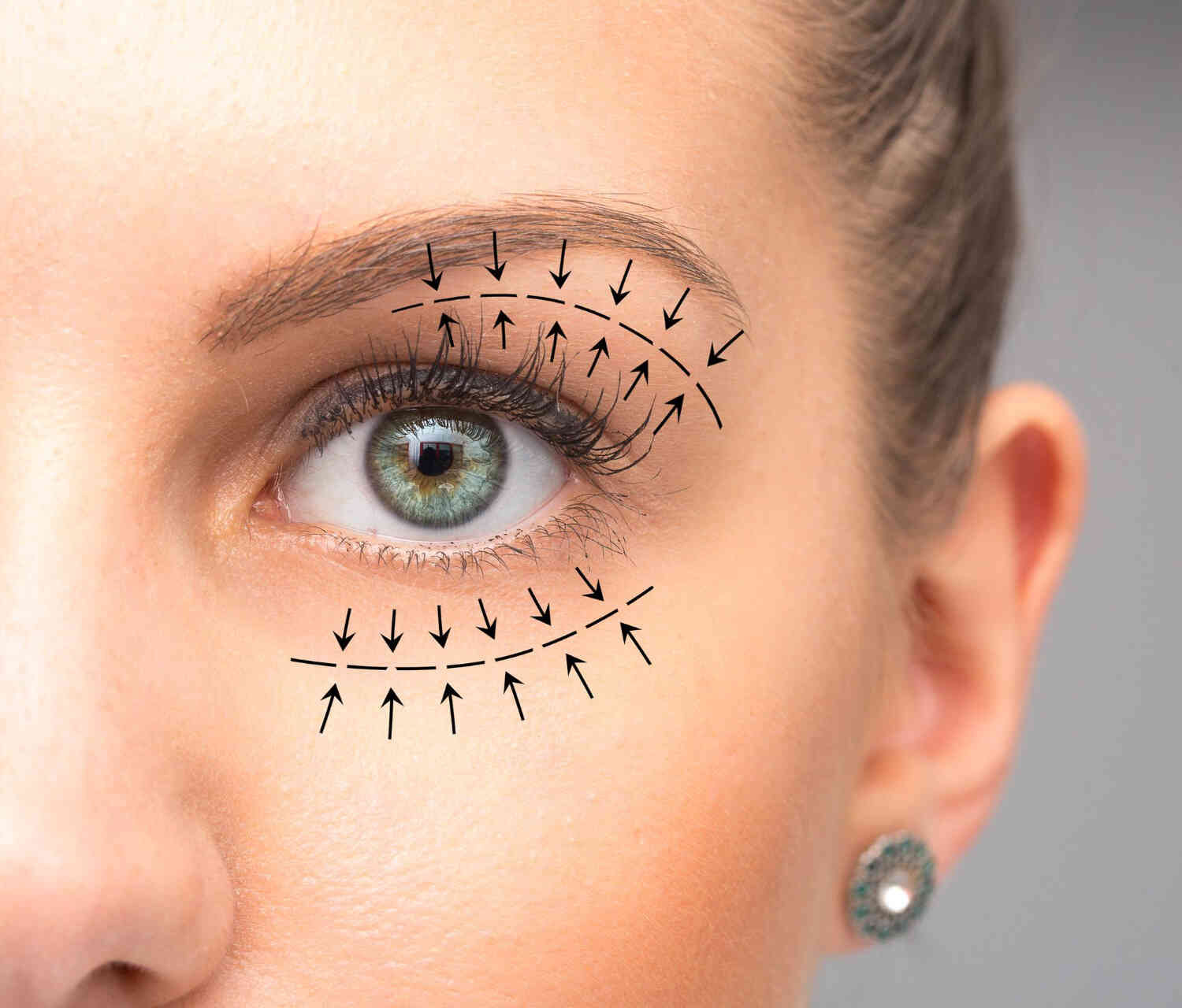 zabiegblepharoplastykinakobiecymoku